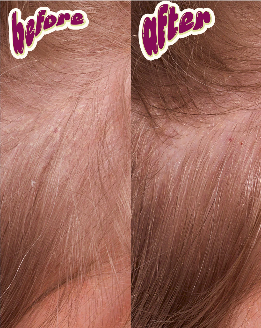 Dandruff Complex - Nourishing Salt-Free Conditioner - Image 5